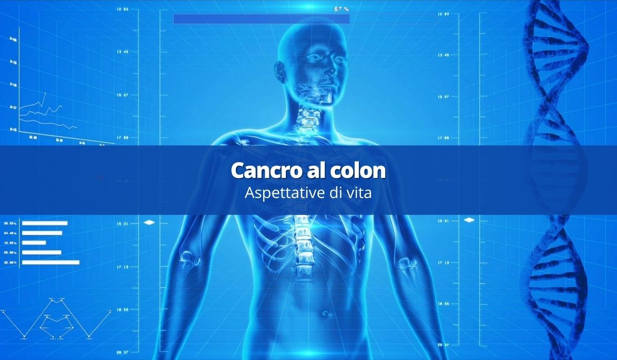 prognosi del cancro al colon